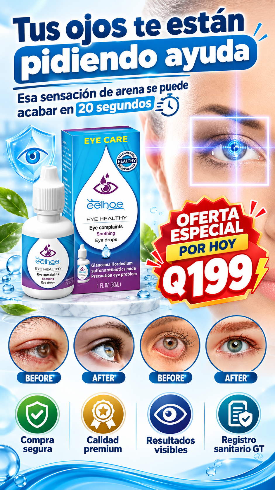 Gotas Eelhoe - Quita carnosidad, orzuelos, irritación, visión borrosa